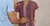 Learn All About Scoliosis