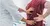 Treatment Spotlight: Radiofrequency Nerve Ablation