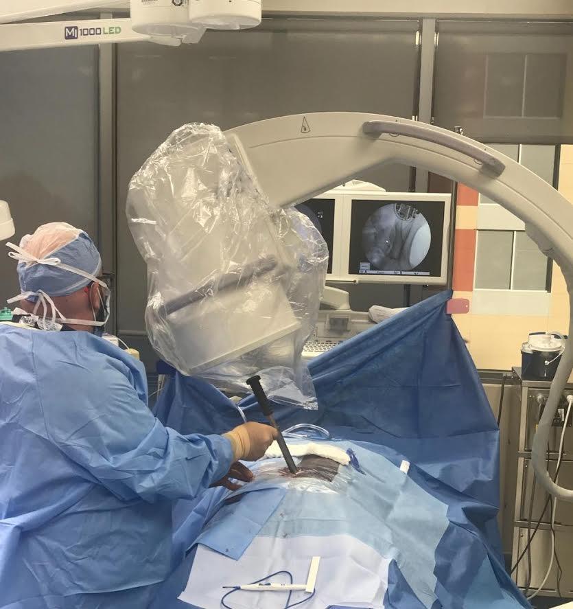 Dr. Rosenfeld Performs New Treatment 1